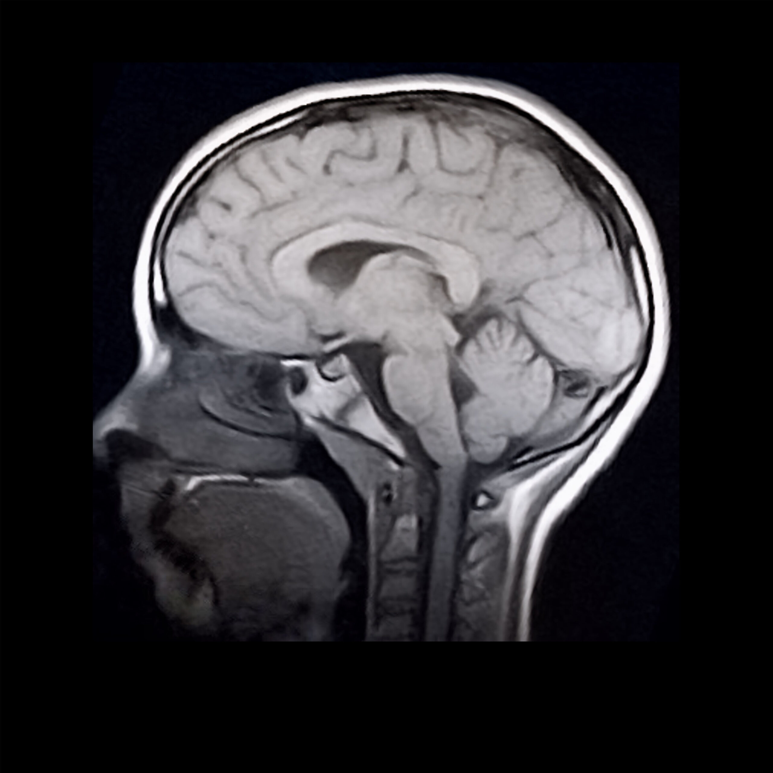 Plan B(ME): Why I’m Glad I Got Rejected